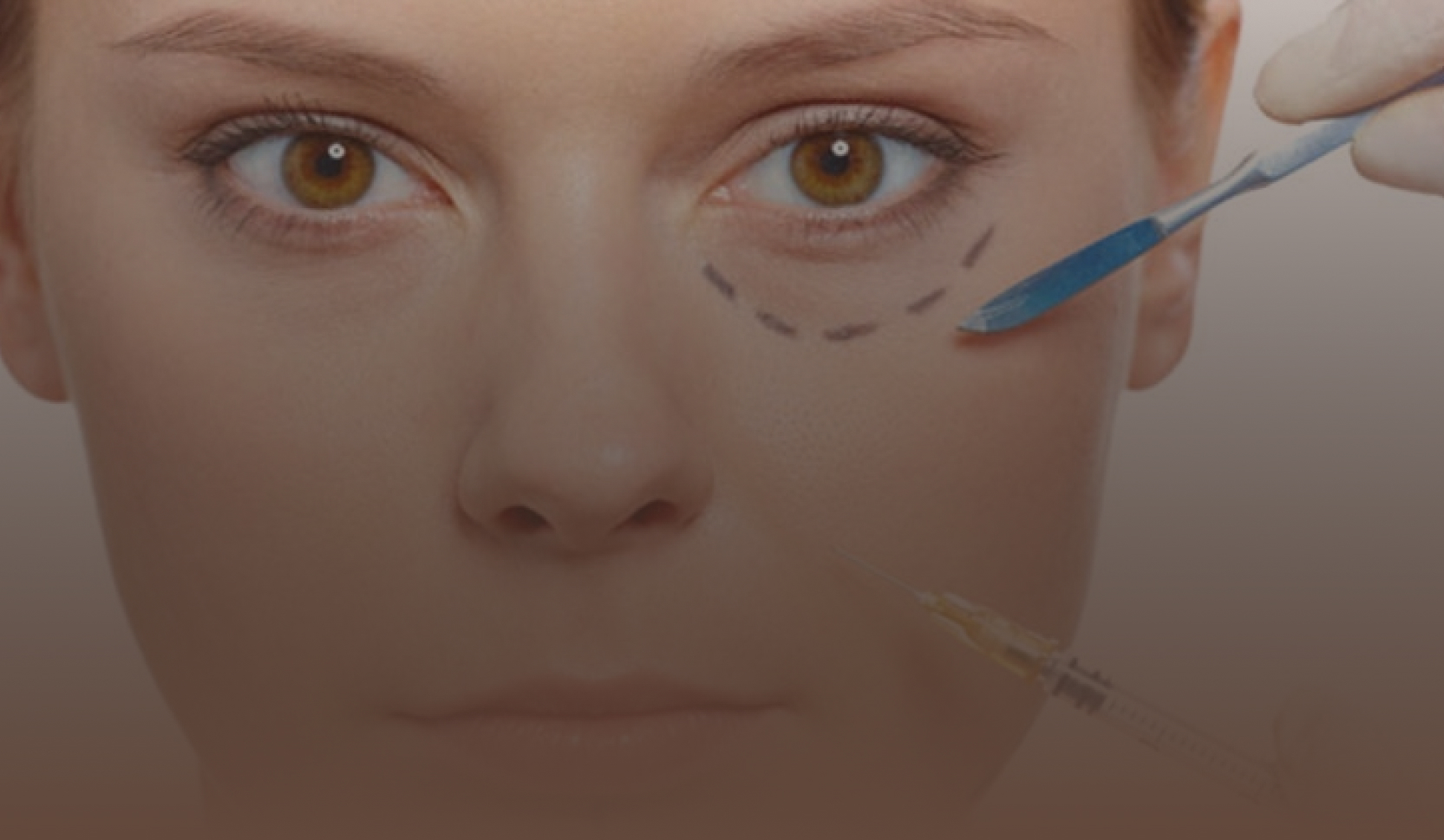 Preenchimento de olheiras em Brusque